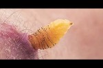 Video - Die Gefährlichsten Insekten der Welt!
