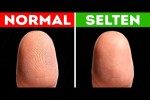 Video - Wie Menschen ohne Fingerabdrücke im Leben klarkommen